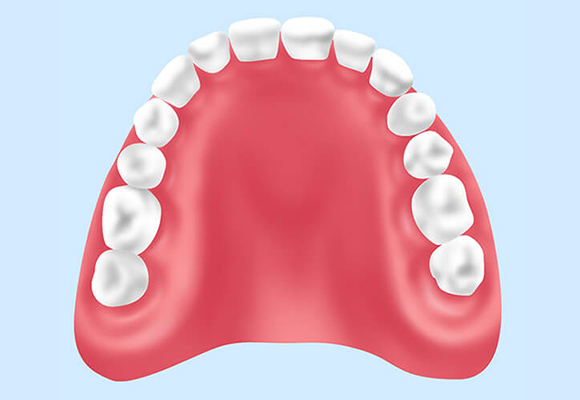 レジン床義歯（歯科用プラスチック製義歯）